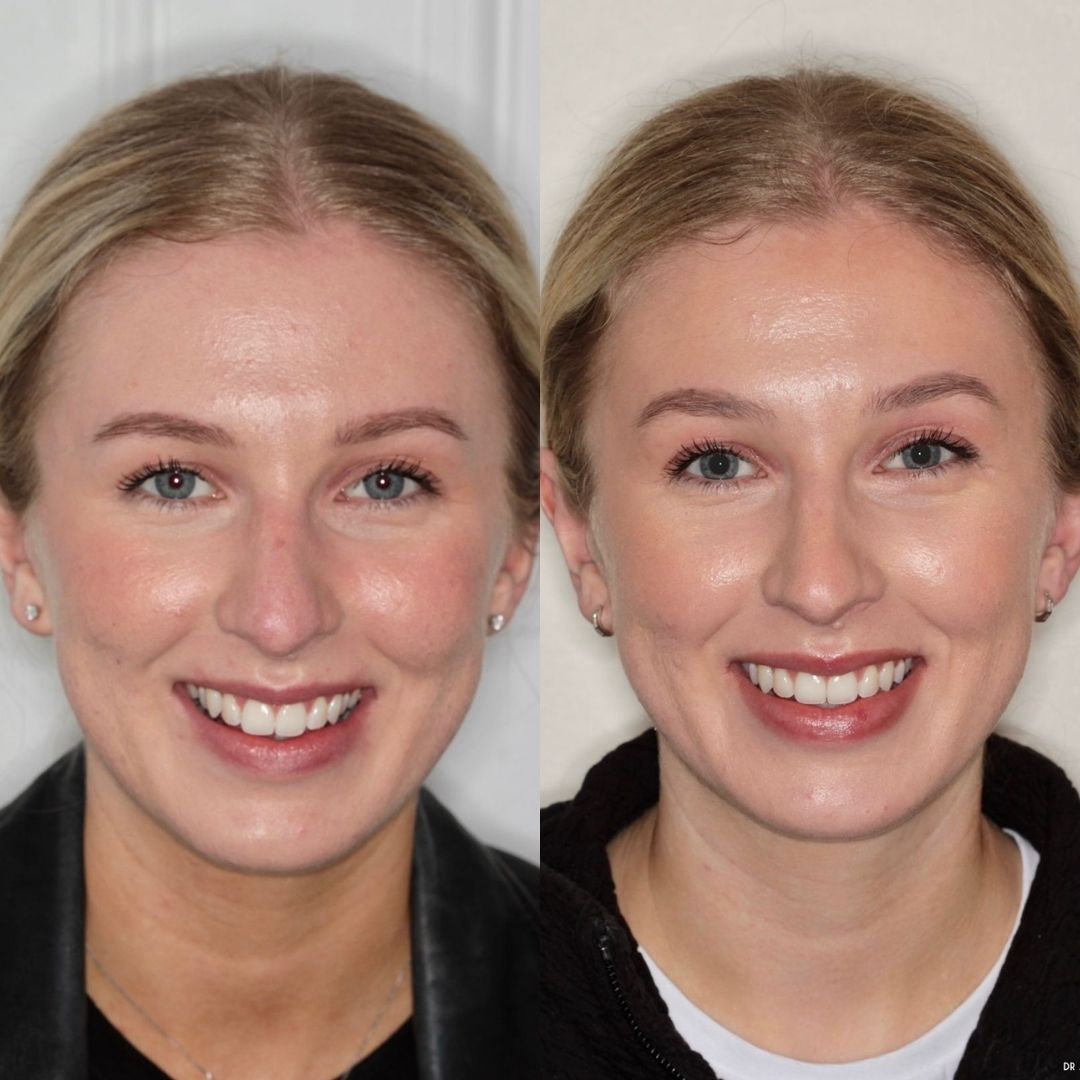 Links Dental Practice | Links Dental Practice in Edinburgh Before and after treatment