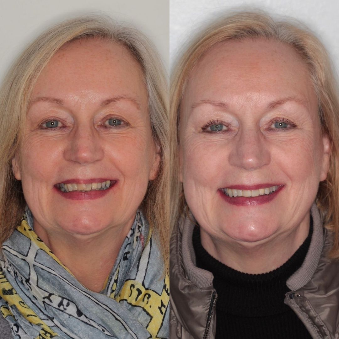 Links Dental Practice | Links Dental Practice in Edinburgh Before and after treatment