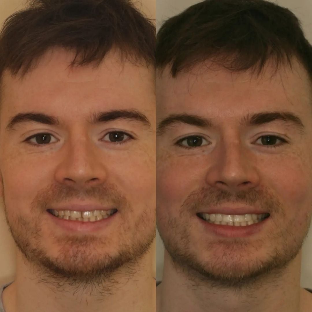 Links Dental Practice | Links Dental Practice in Edinburgh Before and after treatment