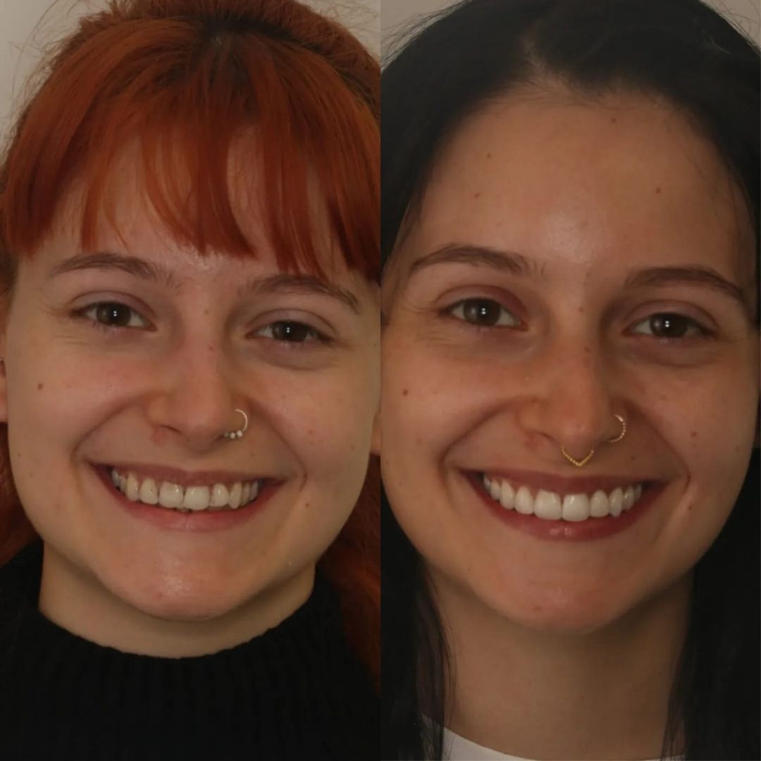 Links Dental Practice | Links Dental Practice in Edinburgh Before and after treatment