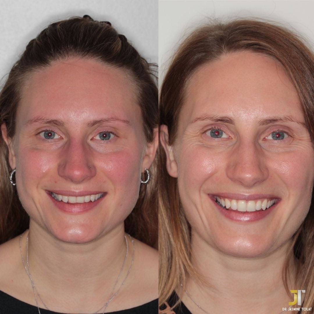 Links Dental Practice | Links Dental Practice in Edinburgh Before and after treatment